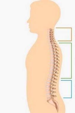 Derrota por osteocondrose de varias partes da columna vertebral